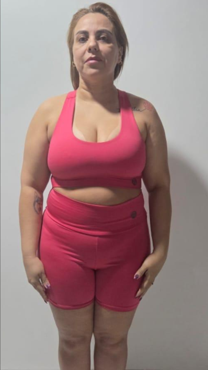 Before and After 7